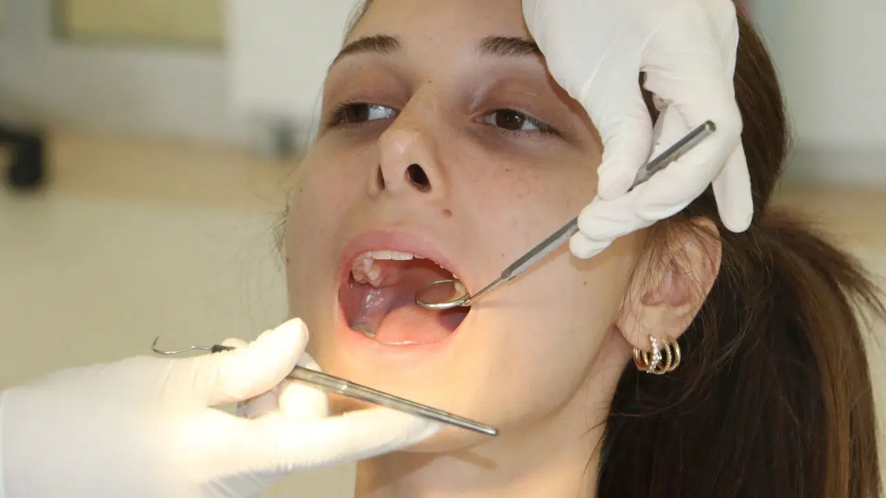 2 haftadan uzun suren agiz yaralari icin dis hekimine basvurulmali D7KKca18