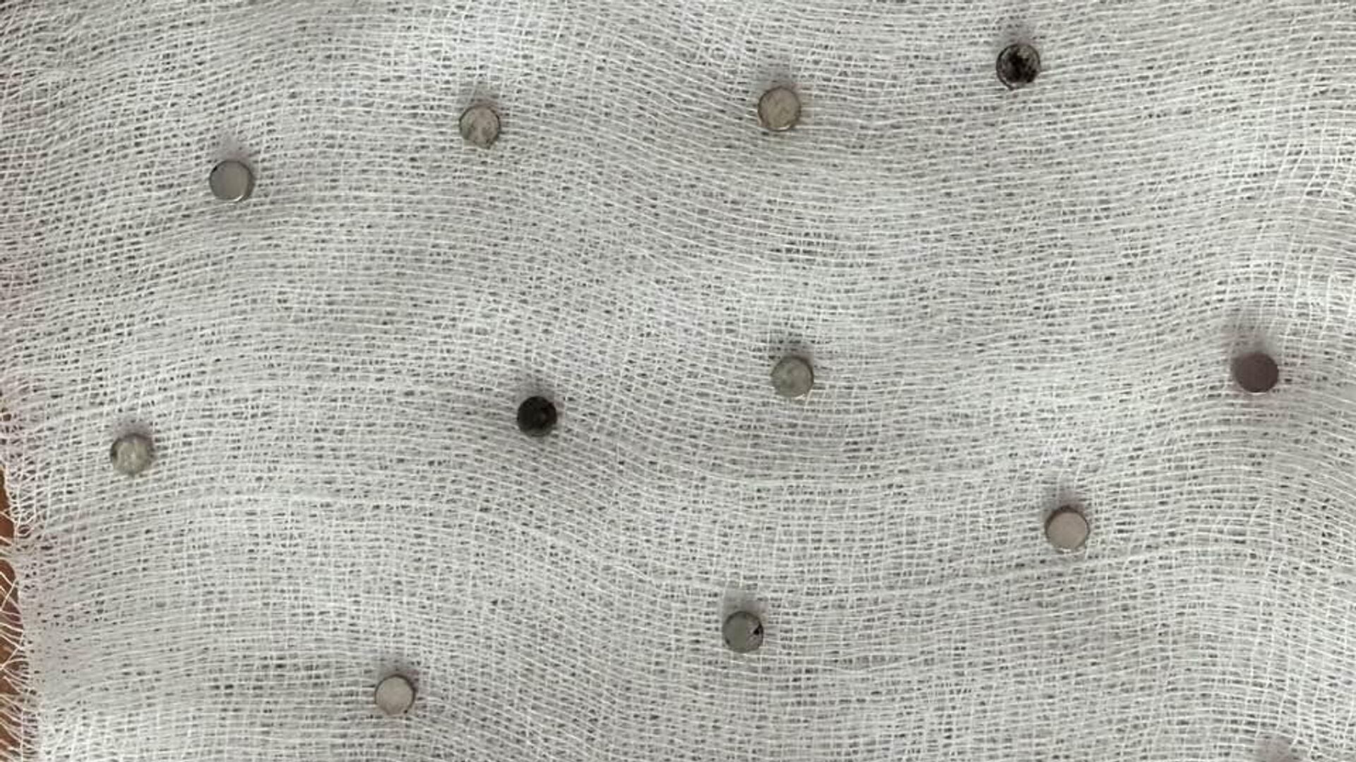 toplam 19 miknatis yemek borusundan cikarildi XIVGyxb2