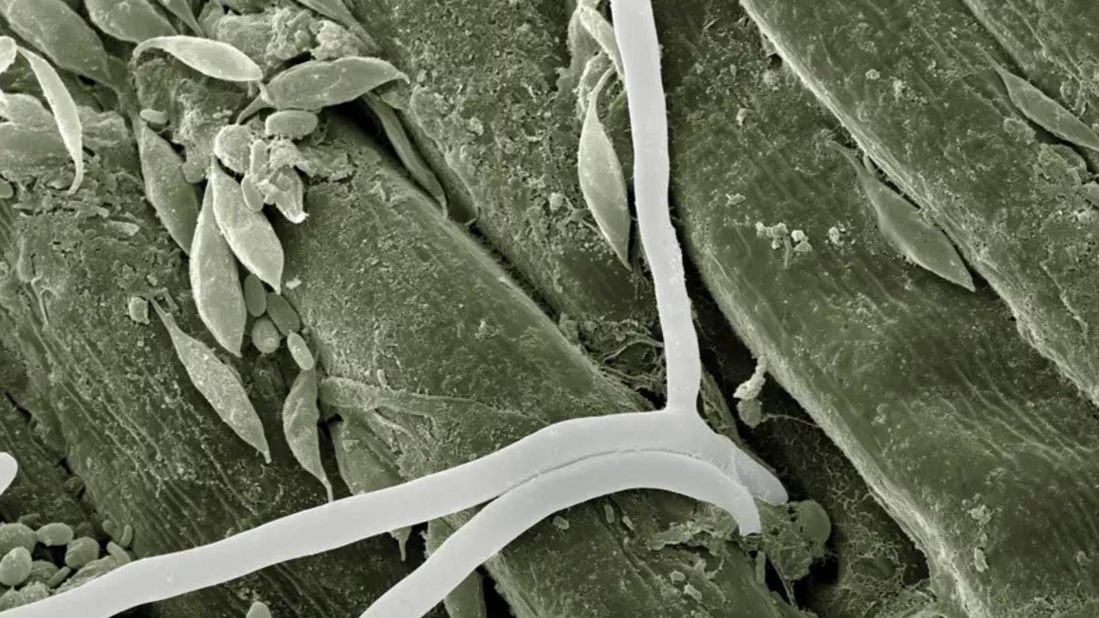 yapay zeka biyoteknolojiyi nasil terore donusturuyor Ozqtqn8h.jpg